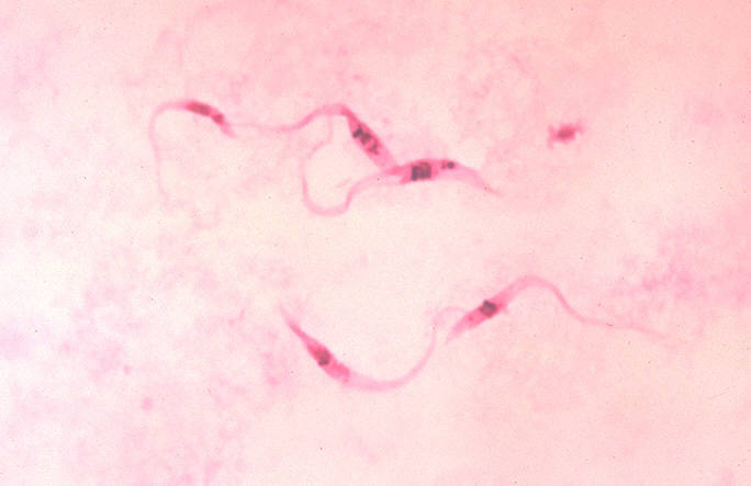 Trypanosoma cruzi overgebracht door de Triatoma infestans (bedwants)